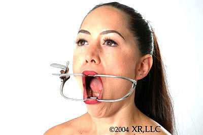Jennings Dental Mouth Gag-0
