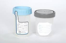 Medegen Sterile Specimen Container, MDG 1068
