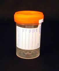 Medegen Non-Sterile Specimen Containers, MDG 4942
