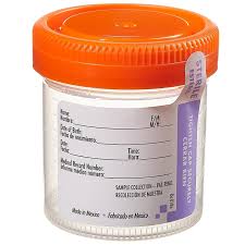 Medegen Non-Sterile Specimen Containers, MDG 4943